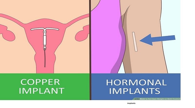 Does Birth Control Make You Gain Weight